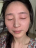 江豆丁膠囊豇豆丁xubn豆膠囊紅豆丁斗訂姜去痘祛痘官方正品旗艦店 店長推薦-周期裝【專攻痤瘡】 曬單實(shí)拍圖