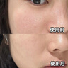 維特絲（vetes）去角質(zhì)面部啫喱控油保濕洗面奶男女士清潔毛孔黑頭閉口溫沒激素和 【6大專利】果酸去角質(zhì)啫喱200g 曬單實拍圖