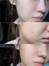 維特絲（vetes）去角質(zhì)面部啫喱控油保濕洗面奶男女士清潔毛孔黑頭閉口溫和不刺激 【6大專利】果酸去角質(zhì)啫喱200g 曬單實拍圖