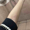 皮脂腺囊腫專用藥膏去除皮下痘痘粉瘤增生脂肪硬塊膿包結(jié)節(jié)暗瘡火癤子專用軟膏皮膚用藥 莫匹羅星軟膏 1盒【皮脂腺囊腫專用藥膏】 曬單實拍圖