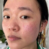 Newliann醫(yī)用重組膠原蛋白修復(fù)敷料乳液人表皮生長(zhǎng)因子凝膠皮膚屏障面霜 曬單實(shí)拍圖