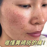 南京同仁堂美白祛斑霜淡化黑色素煙酰胺去斑霜男女專用護膚品50g 曬單實拍圖