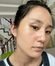 焦博士日本377祛斑霜美白淡化老年黃褐雀斑黑色素熊果苷乳膏去曬男女士 曬單實拍圖