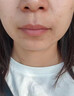 DR.AVIN醫(yī)用點(diǎn)痣疤痕修復(fù)凹洞凝膠黑印去紅印反黑疤痕增生凸起除疙瘩貼BD 送醫(yī)用棉簽【兩盒優(yōu)惠裝】第二盒半價(jià) 曬單實(shí)拍圖