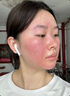 EDRI醫(yī)用補(bǔ)水噴霧械字號曬后修復(fù)小分子透明質(zhì)酸鈉保濕修復(fù)皮膚屏障 曬單實(shí)拍圖