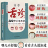 自學(xué)舌診：300種舌象圖譜 曬單實(shí)拍圖