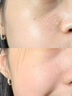 OHBT祛痘膏60g青春痘閉孔粉刺收縮毛孔專用學(xué)生男女凝膠男士化妝品 曬單實拍圖
