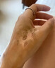 紐醫(yī)生燙傷膏熱油開水灼傷電焊紅腫起泡不留疤痕濕潤軟膏外用抑菌燒傷膏 曬單實(shí)拍圖