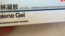 [硬核醫生]阿達帕林凝膠 0.1%*9g 1盒裝 0.1%*9g/盒 玫瑰痤瘡膏祛痘痘印藥膏重度暗瘡 曬單實(shí)拍圖
