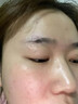 DRVIALY扁平疣專用尖銳濕疣去疣體瘊子特藥膏絲狀疣型瘊靈去除脖子小肉粒 3盒裝【頑固疣體-100%特效果】 曬單實(shí)拍圖