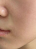 南京同仁堂祛痘膏去痘痘和痘印痘坑修復(fù)男女士改善粉刺閉口30g 曬單實拍圖