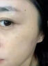 維a酸乳膏去老年斑專用的藥一夜臉部手背消強(qiáng)力祛斑專用霜去老人斑除黃褐雀斑黑色素男女士醫(yī)用官方正品藥膏 1盒乳膏【臉部手背老年斑】100%發(fā)貨特效快 曬單實(shí)拍圖