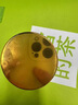 脂肪粒去除藥膏神器眼部專用眼霜消除汗管瘤脂肪油脂粒粟丘疹克星 特效:一盒裝 曬單實(shí)拍圖