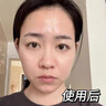 Losoki瑞士進口氨基酸洗面奶美白控油祛痘除螨蟲去黑頭男女士專用潔面乳 曬單實拍圖