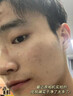 南京同仁堂祛痘膏去痘痘和痘印痘坑修復(fù)男女士改善粉刺閉口30g 曬單實拍圖