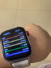 智能手機(jī)watch 2025升級(jí)款精準(zhǔn)測(cè)血糖血壓血脂心率運(yùn)動(dòng)健康手環(huán) 【晶鉆銀】高精度芯片+全方位體檢功能 全新升級(jí)款芯片 曬單實(shí)拍圖
