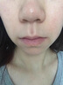 華美科醫(yī)用重組人體表皮生長(zhǎng)因子點(diǎn)痣疤痕修復(fù)凝膠燙軟膏傷口愈合15g1支 曬單實(shí)拍圖