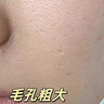 儒意（RUYI）紫蘇壬二酸清潔泥膜150g 面膜深層去黑頭收縮毛孔祛痘金榜第1名 曬單實(shí)拍圖