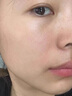 OHBT祛痘膏60g青春痘閉孔粉刺收縮毛孔專用學(xué)生男女凝膠男士化妝品 曬單實(shí)拍圖