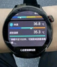 喵醫(yī)生【五臟微監(jiān)測】華為機鴻蒙系統(tǒng)蘋果機IOS適用動態(tài)智能血壓監(jiān)測手表血糖趨勢評估血脂尿酸健康手環(huán) MET760【血糖血壓+真零感監(jiān)測】 曬單實拍圖