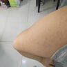 優(yōu)立特手臂毛囊炎專用噴霧劑胳膊上長小疙瘩小紅點雞皮膚毛周囊角化癥BC 2盒【優(yōu)惠裝】第二盒半價 曬單實拍圖