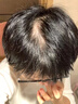 同仁堂【發(fā)量翻倍漲】育發(fā)液防脫發(fā)育發(fā)濃密增長(cháng)液頭發(fā)生長(cháng)激活毛囊增發(fā) 第2瓶半價(jià)【輕度脫發(fā)】激活毛囊 曬單實(shí)拍圖