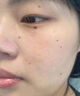麥歌利激光筆點(diǎn)痣筆美容院祛斑儀家用洗紋身激光機(jī)無(wú)創(chuàng)點(diǎn)痣掃斑神器臉部點(diǎn)小肉粒肉芽脂肪粒 冰川銀全配款 限定禮盒 曬單實(shí)拍圖