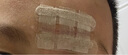 Omnistrip 醫(yī)用皮膚減張貼 免縫剖腹產(chǎn)術后敷料 膚色12*102mm*10包 共60條  曬單實拍圖