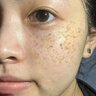 焦博士日本377祛斑霜美白淡化老年黃褐雀斑黑色素熊果苷乳膏去曬男女士 曬單實(shí)拍圖