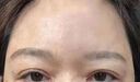 絲幕川字紋去除神器貼額頭抬頭紋去除男女士重度法令紋皺紋抗衰老專(zhuān)用 一盒裝【日本進(jìn)口】一抹消 曬單實(shí)拍圖