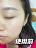 韓方五谷377美白補水保濕精華液次拋祛斑提亮去黃護膚品抗氧煙酰胺男女士 曬單實拍圖