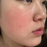 韓方五谷蘆薈膠舒緩凝膠面霜曬后修護(hù)褪紅補水保濕祛痘淡化疤痕乳液男女士 曬單實拍圖
