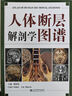 人體解剖彩色圖譜 丁自海 鄭雪峰 臨床醫(yī)學(xué)外科學(xué)教材書系統(tǒng)局部解刨學(xué)醫(yī)學(xué)書籍全彩局部系統(tǒng)實用解剖彩繪本科大學(xué)教材山東科學(xué)技術(shù)出版社 9787572321580 人體斷層解剖學(xué)圖譜 曬單實拍圖