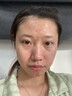 南京同仁堂祛痘膏去痘痘和痘印痘坑修復(fù)男女士改善粉刺閉口30g 曬單實(shí)拍圖