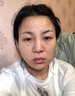 焦博士日本377祛斑霜美白淡化老年黃褐雀斑黑色素熊果苷乳膏去曬男女士 曬單實拍圖