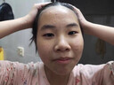 維特絲壬二酸祛痘藥膏去痘痘粉刺閉口收毛孔男女煙酰胺水楊酸青少年凝膠 曬單實(shí)拍圖