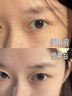 儒意（RUYI）水楊酸面膜20片祛痘淡痘印果酸控油清潔收縮毛孔女男士補水青少年 曬單實拍圖