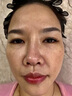 片仔癀美白淡斑精華液淡化黑色素老年黃褐雀斑煙酰胺去黃提亮膚色護膚品 一瓶40ml 曬單實拍圖