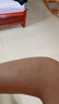 茉博士香港大藥房去痣點(diǎn)痣膏藥水臉部不留疤黑痣無(wú)痛修復(fù)液兒童可用 曬單實(shí)拍圖