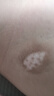 SIGMA希格瑪308白癜風(fēng)治療儀銀屑病家用光療儀紫外線光燈準(zhǔn)分子西格瑪 60強(qiáng)度 FFH 308光療儀+光療禮包 曬單實(shí)拍圖