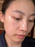 儒意（RUYI）377美白精華液淡斑面部抗皺緊致提亮去黃祛痘印煙酰胺抗氧補(bǔ)水 曬單實拍圖
