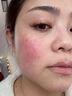 奈皙日本曬后修復(fù)急救皮膚屏障受損泛紅積雪草曬傷藥膏男士醫(yī)美用煥白 曬單實(shí)拍圖