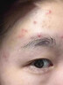 南京同仁堂祛痘膏去痘痘和痘印痘坑修復(fù)男女士改善粉刺閉口30g 曬單實(shí)拍圖