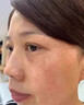 東田日本進口老年斑的藥美白祛斑第1名專用臉部手背祛斑霜100%特俲藥 一盒【體驗款】 曬單實拍圖