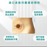 家悅康造口防漏圈可塑防漏貼環(huán)造口護理用品造瘺袋防漏膠圈 2mm防漏圈10個/1盒 曬單實拍圖