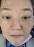 川廿制藥醫(yī)用煙酰胺凝膠美白精華液去斑祛斑美白淡化去黑色素男士專(zhuān)用變白 曬單實(shí)拍圖