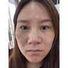 秋雅奈緒川字紋去除神器男女去重度抬頭紋皺紋法令紋提拉緊致懸紋祛除藥膏 1支裝【老款】 曬單實(shí)拍圖