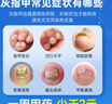 楚甲 鹽酸阿莫羅芬搽劑 5%*3ml*2盒 國藥準(zhǔn)字治療灰指甲專用藥灰指甲正品真菌感染皮膚用藥抑菌液阿莫羅芬搽劑正品旗艦店 曬單實(shí)拍圖