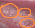 重組人a2b干擾素噴劑口腔手足口噴霧劑兒童可搭α2b非凝膠hpv感染尖銳濕疣扁平絲狀疣用 口腔手足口尖銳濕疣扁平絲狀疣用 重組人干擾a2b噴劑【一盒裝】 曬單實(shí)拍圖