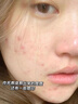OHBT氨基酸植萃洗面奶300g控油祛痘除螨蟲深層清潔黑頭男士女士潔面乳 曬單實拍圖